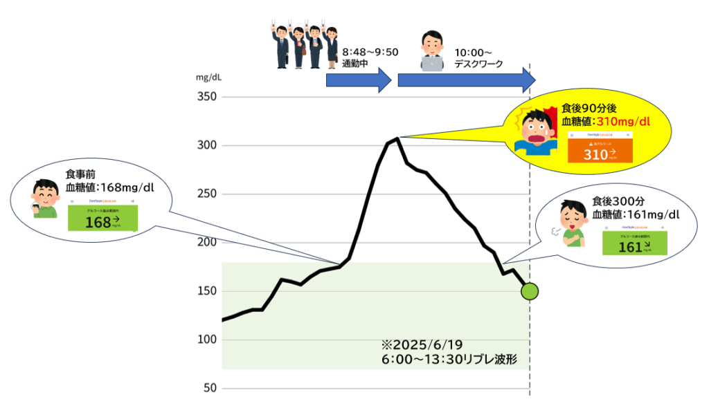 通勤中のリブレ血糖値波形_最高血糖値310mg/dl